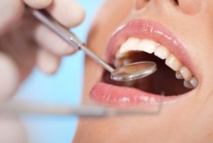 teeth cleaning red bank